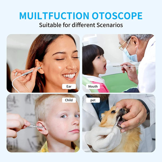 Digital Otoscope by [Brand Name]: 1080P HD Ear Scope with 3.9mm Camera & Rechargeable 2500mAh Battery for Clear Ear Cleaning