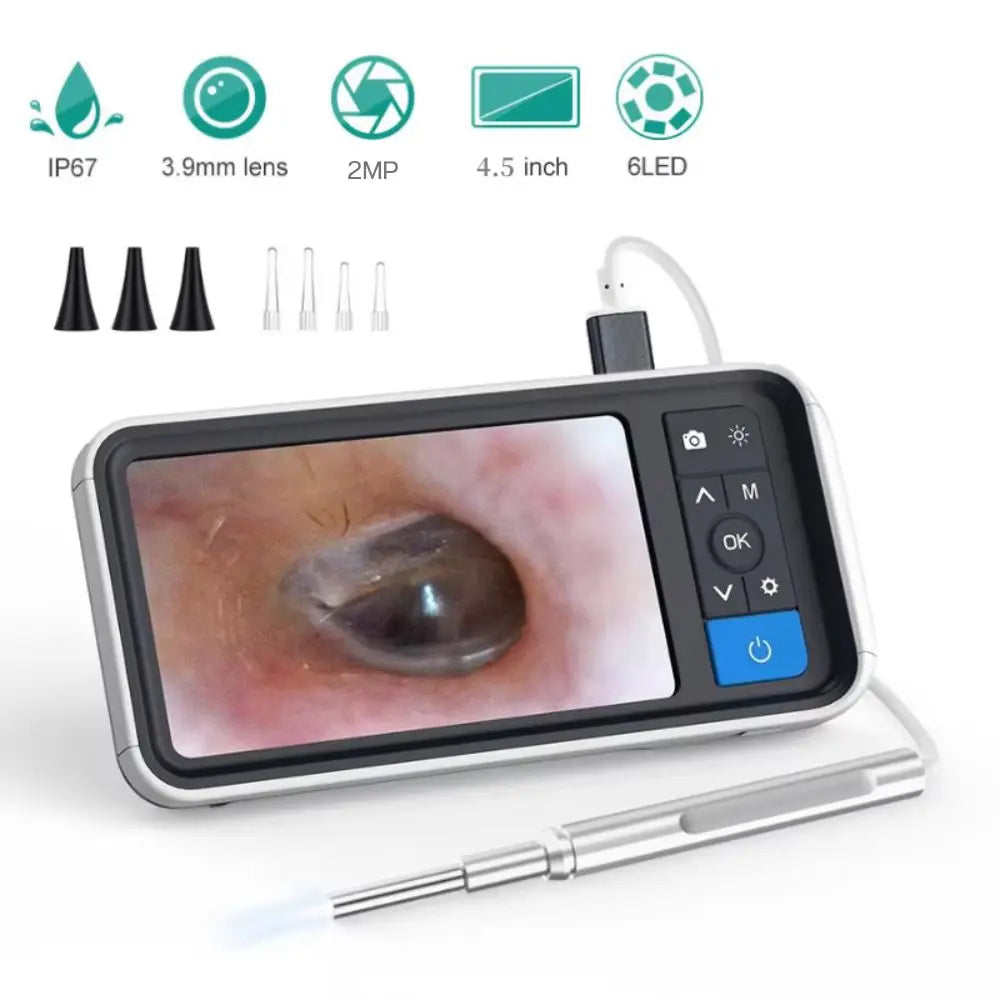 Digital Otoscope by [Brand Name]: 1080P HD Ear Scope with 3.9mm Camera & Rechargeable 2500mAh Battery for Clear Ear Cleaning