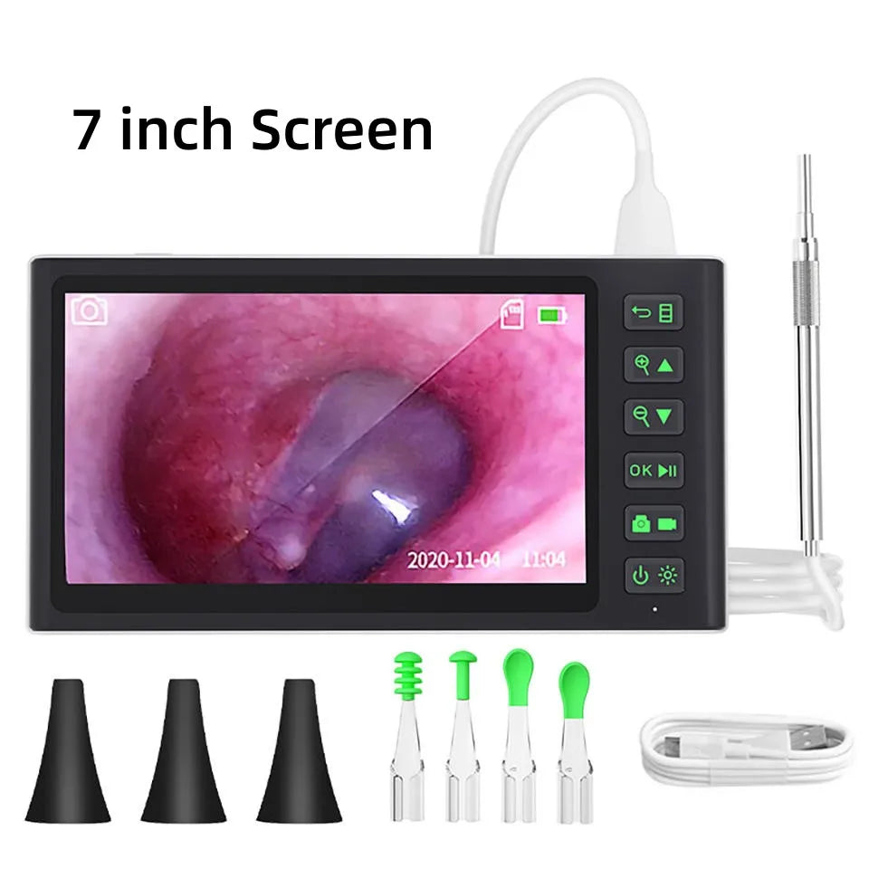Digital Otoscope by [Brand Name]: 1080P HD Ear Scope with 3.9mm Camera & Rechargeable 2500mAh Battery for Clear Ear Cleaning
