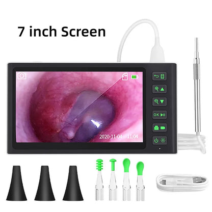 Digital Otoscope by [Brand Name]: 1080P HD Ear Scope with 3.9mm Camera & Rechargeable 2500mAh Battery for Clear Ear Cleaning